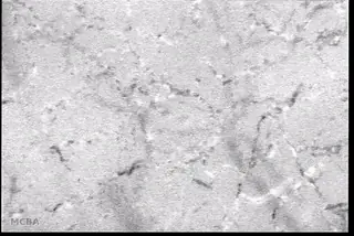 Figure 2: Magnified microcirculatory flow to highlight clear bloodflow.