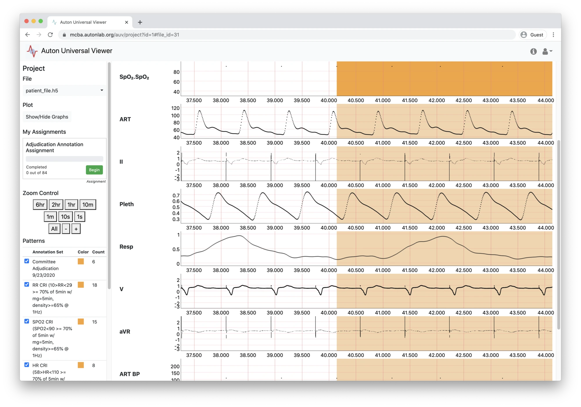 Figure 1: auviewer, a real-time medical data viewing and analysis tool.